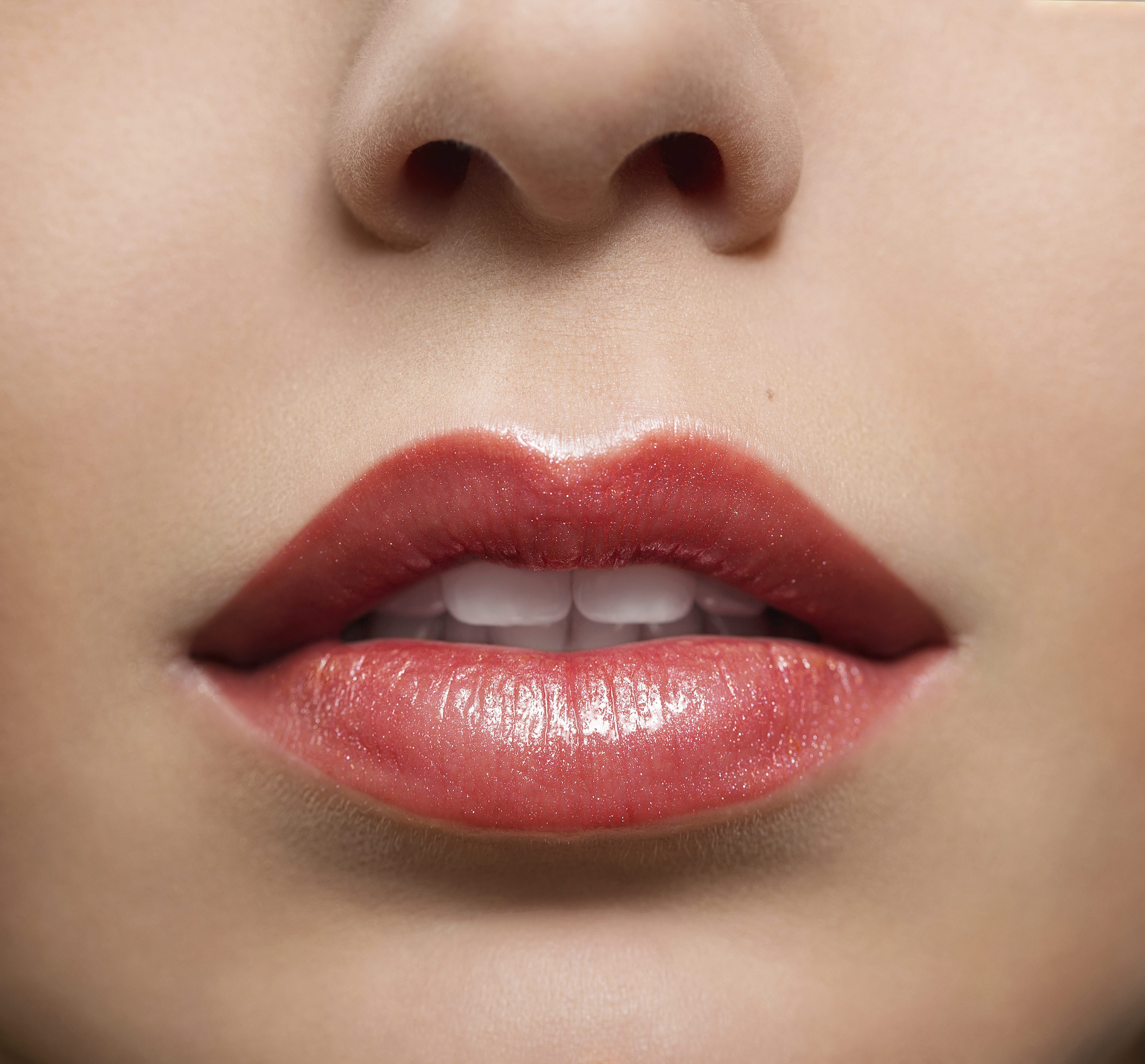 Restylane lip injections