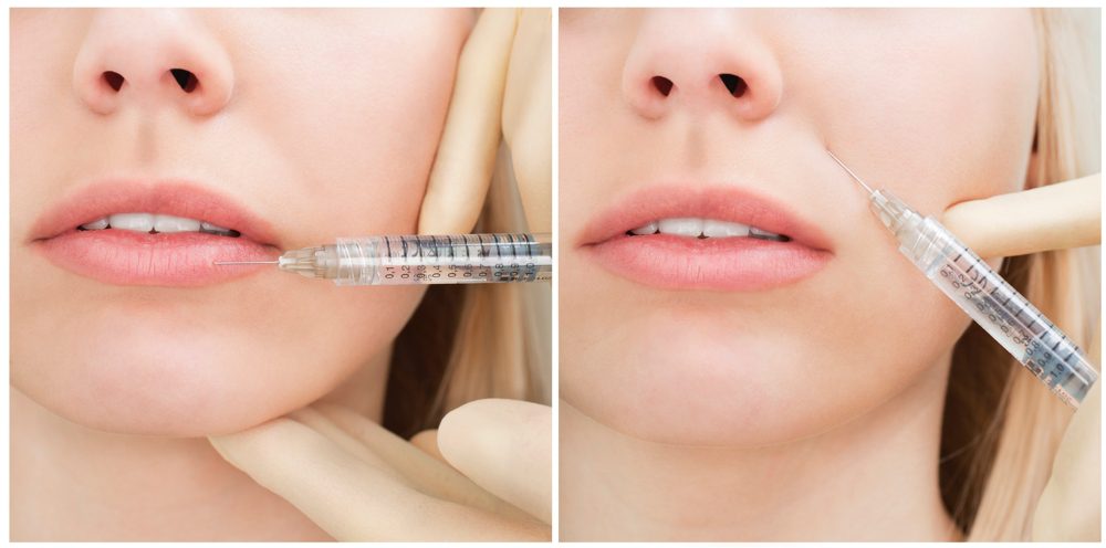 patient receiving Botox and dermal fillers injections