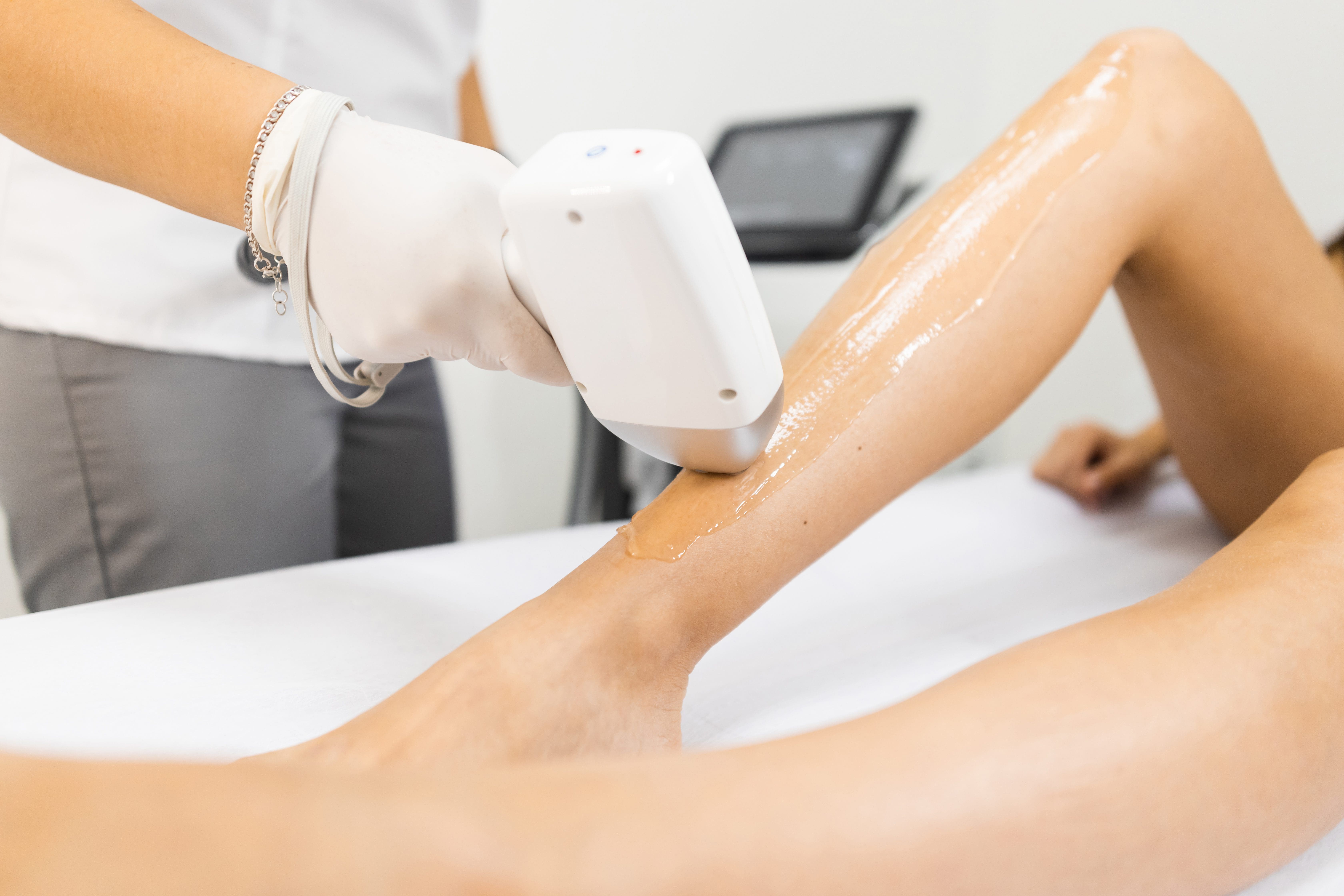 Laser Hair Removal San Diego: The Ultimate Guide to Smooth, Hair-Free Skin  - San Diego Body Contouring | Plastic Surgery