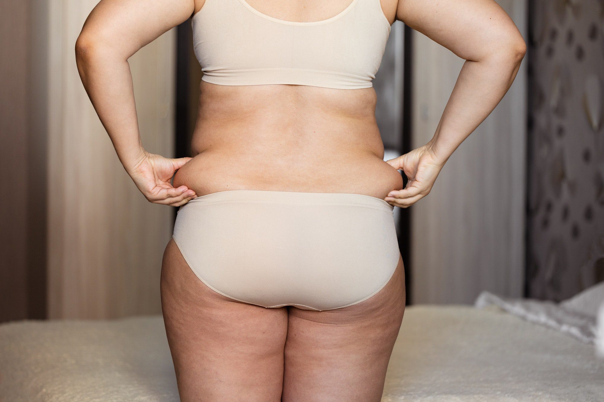 CoolSculpting vs. Traditional Fat Removal Methods: What’s Best for You?
